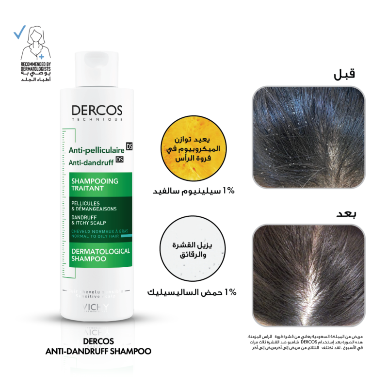 فيشي شامبو للقشرة 200 مل Vichy anti dandruff shampoo