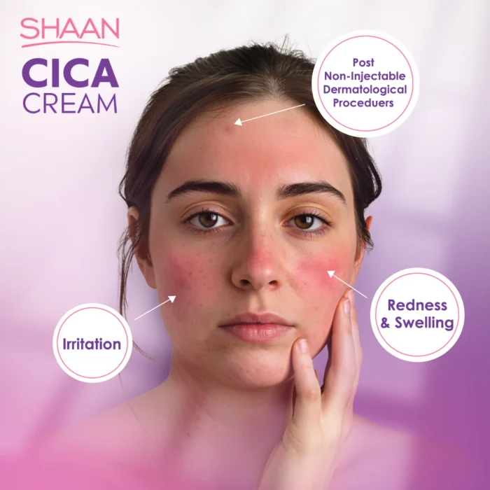 shaan cica cream shaan cica cream