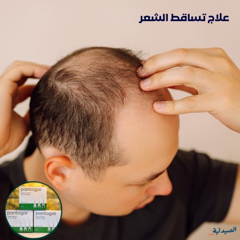 متى يظهر مفعول بانتوجار | بديل زراعة الشعر
