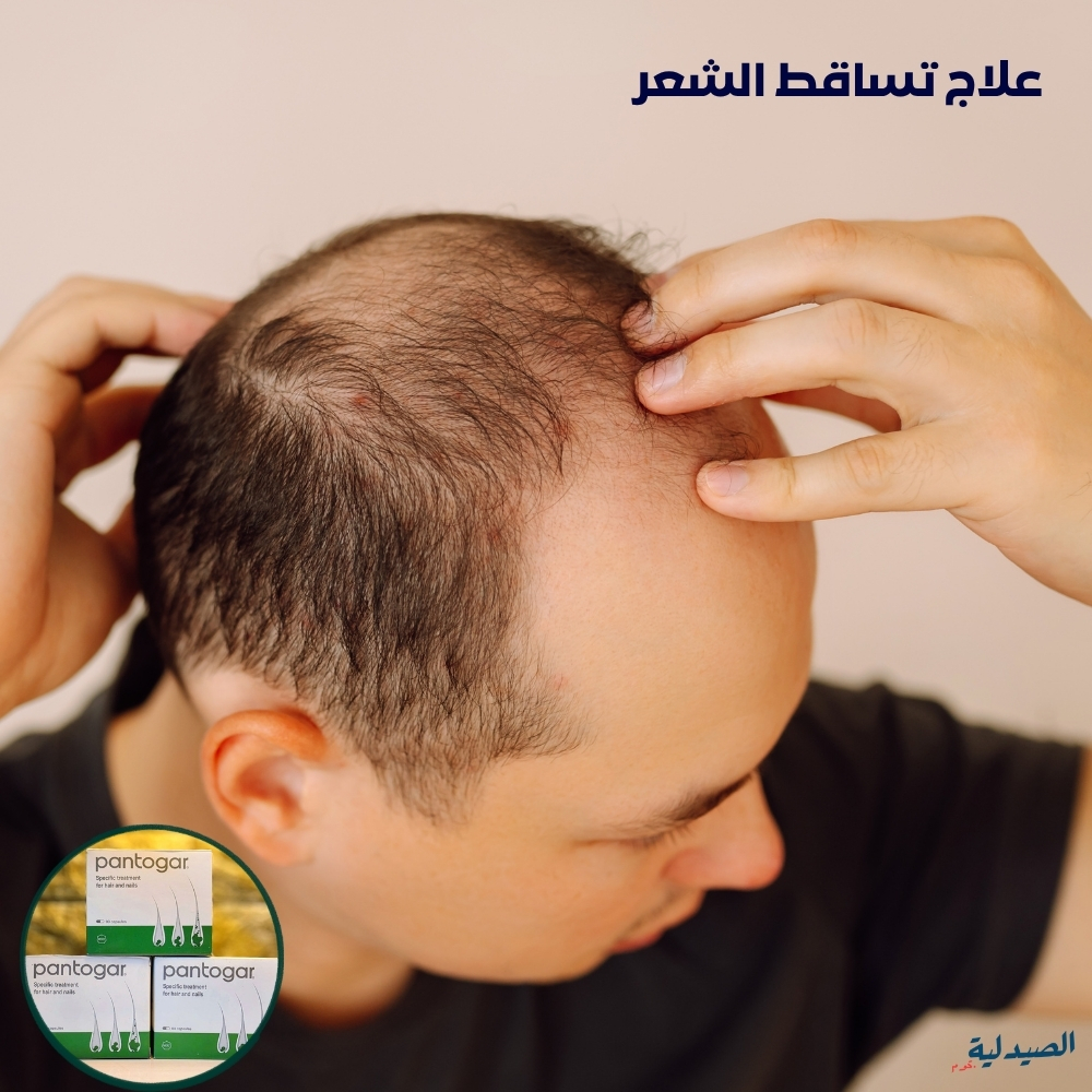 متى يظهر مفعول بانتوجار | بديل زراعة الشعر