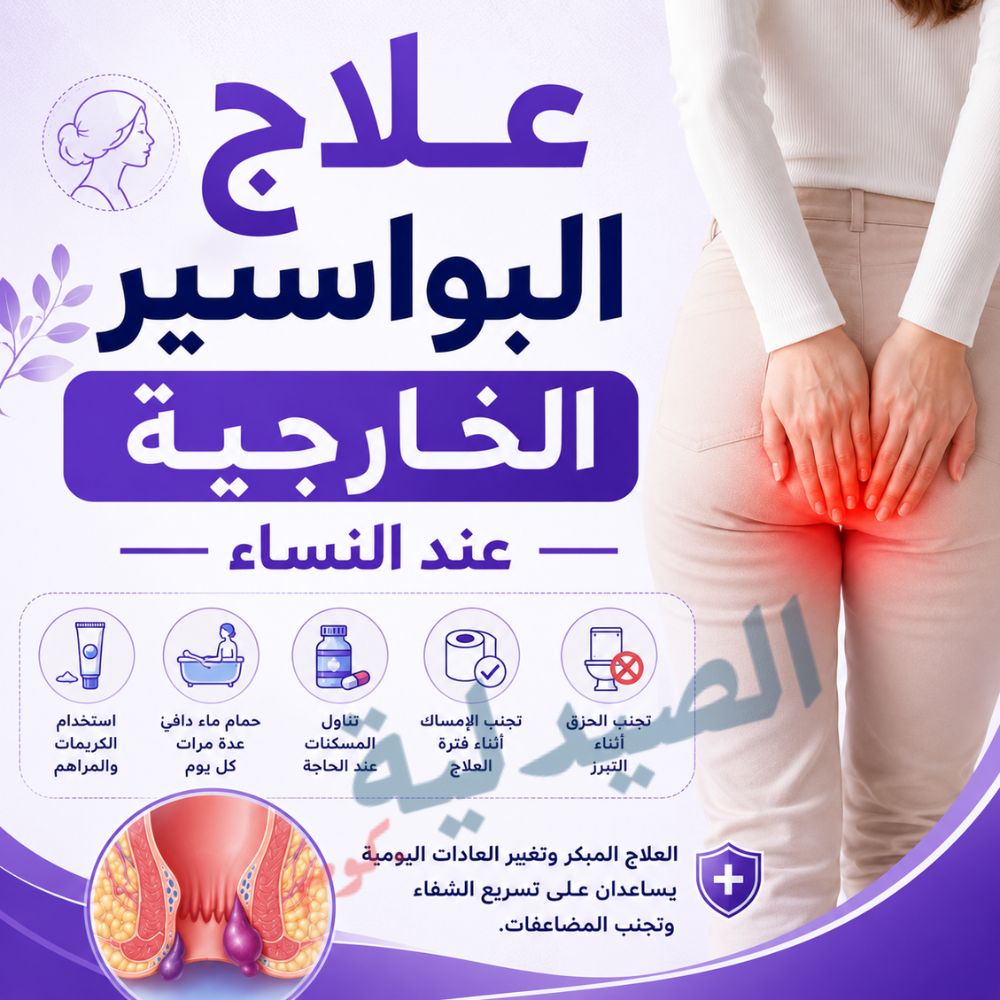 علاج البواسير الخارجية عند النساء