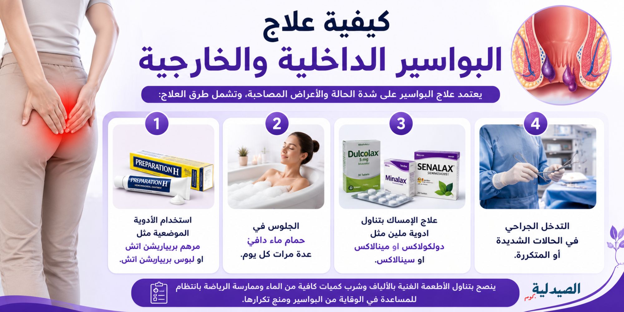 علاج البواسير الداخلية والخارجية - علاج البواسير عند النساء