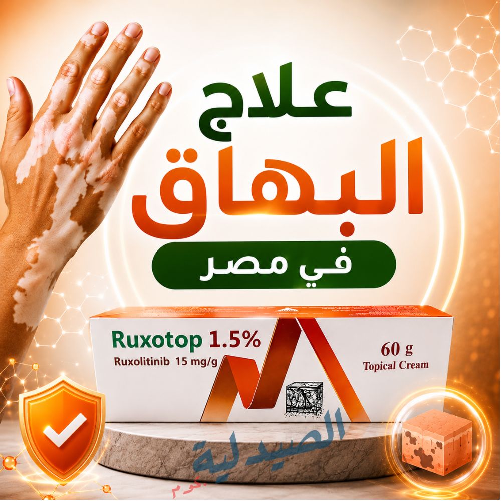 علاج البهاق في مصر - علاج البهاق في الوجه