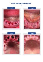 ثيرافيكس اورال كير بلس Theravex Oral Care Plus (1)