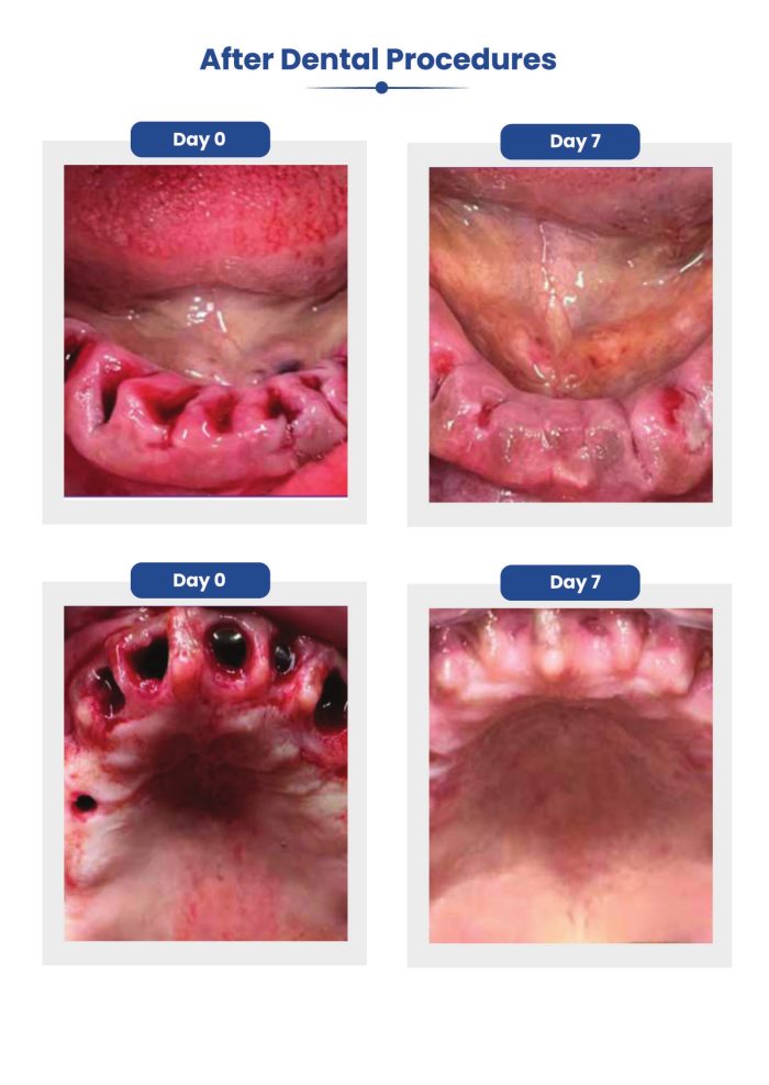 ثيرافيكس اورال كير بلس Theravex Oral Care Plus (1)